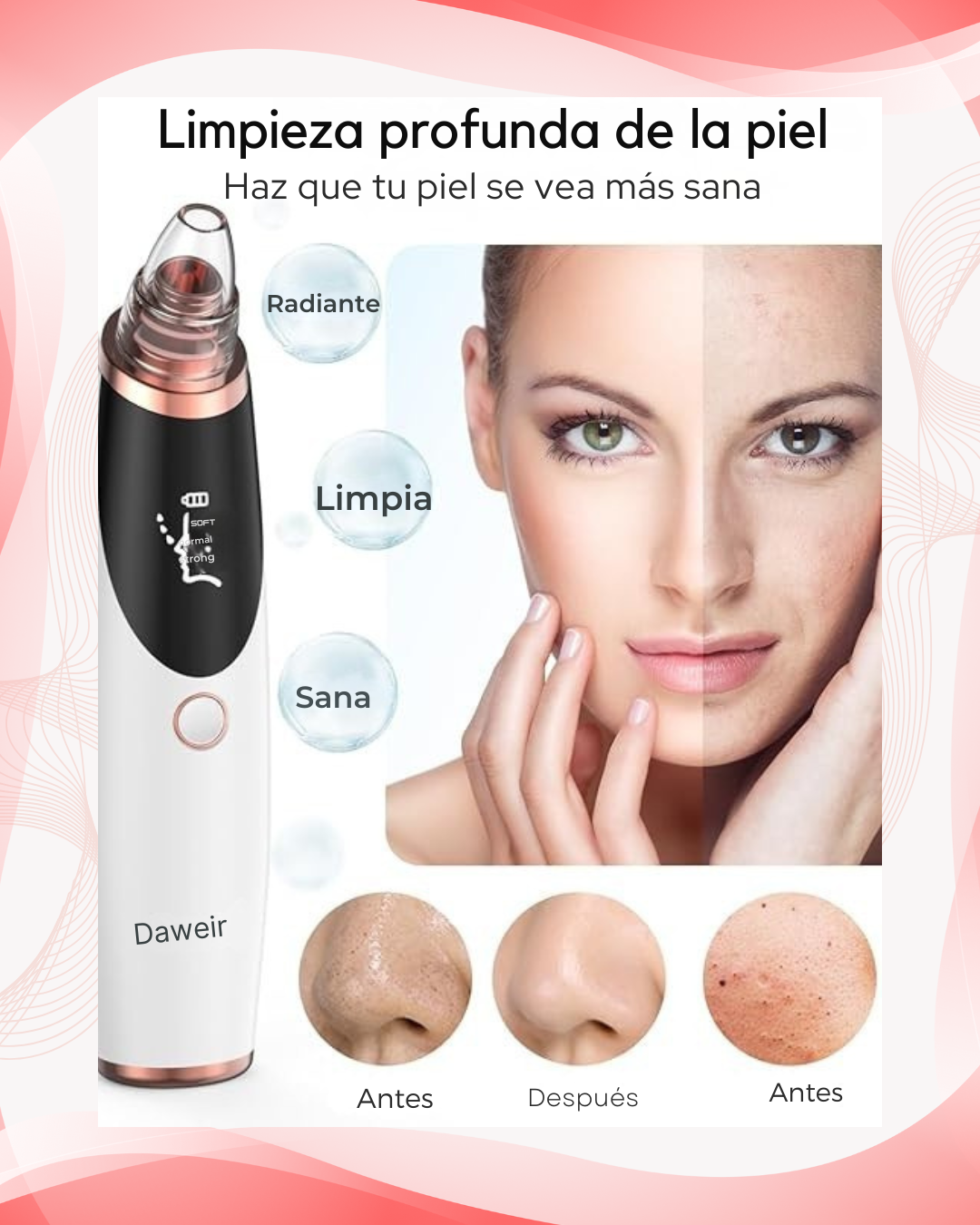 PISTOLA LIMPIADORA FACIAL DE POROS